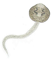 220px-Fascioloides magna cercariae